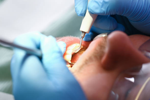 Best Emergency TMJ Treatment in Belford, NJ
